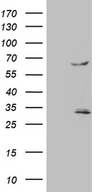 TRAF5 Antibody - HEK293T cells were transfected with the pCMV6-ENTRY control. (Left lane) or pCMV6-ENTRY TRAF5. (Right lane) cDNA for 48 hrs and lysed. Equivalent amounts of cell lysates. (5 ug per lane) were separated by SDS-PAGE and immunoblotted with anti-TRAF5. (1:500)