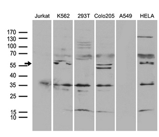 TRAF5 Antibody - Western blot analysis of extracts. (35ug) from 6 different cell lines by using anti-TRAF5 monoclonal antibody. (1:500)