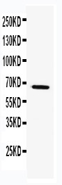 TRAF5 Antibody - WB of TRAF5 antibody. WB: k562 Cell Lysate.