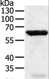 TRAF5 Antibody - Western blot analysis of Jurkat cell, using TRAF5 Polyclonal Antibody at dilution of 1:450.