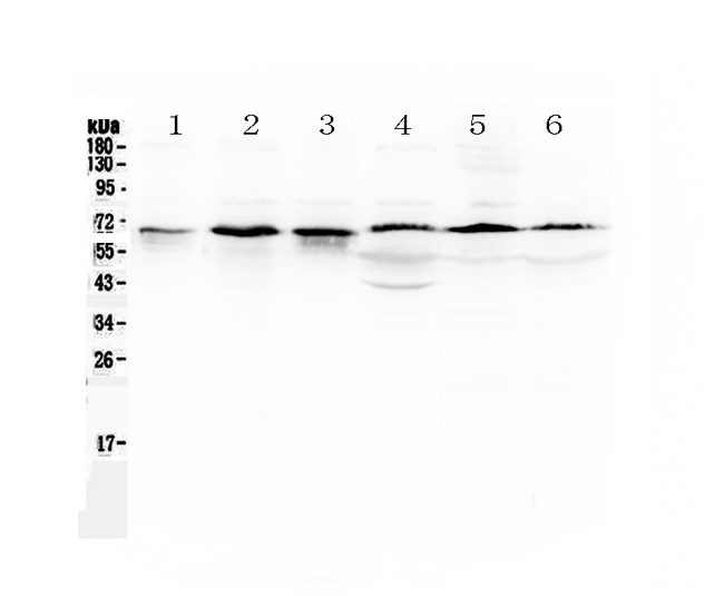TRAF5 Antibody - Western blot analysis of TRAF5 using anti-TRAF5 antibody. Electrophoresis was performed on a 5-20% SDS-PAGE gel at 70V (Stacking gel) / 90V (Resolving gel) for 2-3 hours. The sample well of each lane was loaded with 50ug of sample under reducing conditions. Lane 1: rat ovary tissue lysate,Lane 2: mouse testis tissue lysate,Lane 3: mouse thymus tissue lysate,Lane 4: human MCF-7 whole cell lysate,Lane 5: human A549 whole cell lysate,Lane 6: human Hela whole cell lysate. After Electrophoresis, proteins were transferred to a Nitrocellulose membrane at 150mA for 50-90 minutes. Blocked the membrane with 5% Non-fat Milk/ TBS for 1.5 hour at RT. The membrane was incubated with rabbit anti-TRAF5 antigen affinity purified polyclonal antibody at 0.5 µg/mL overnight at 4°C, then washed with TBS-0.1% Tween 3 times with 5 minutes each and probed with a goat anti-rabbit IgG-HRP secondary antibody at a dilution of 1:10000 for 1.5 hour at RT. The signal is developed using an Enhanced Chemiluminescent detection (ECL) kit with Tanon 5200 system. A specific band was detected for TRAF5 at approximately 64KD. The expected band size for TRAF5 is at 64KD.