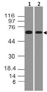 TRAF5 Antibody - Fig-1: Western blot analysis of TRAF5. Anti-TRAF5 antibody was used at 2 µg/ml on A431 and A549 lysates.