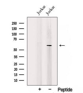 TRAF5 Antibody - Western blot analysis of extracts of Jurkat cells using TRAF5 antibody. The lane on the left was treated with blocking peptide.
