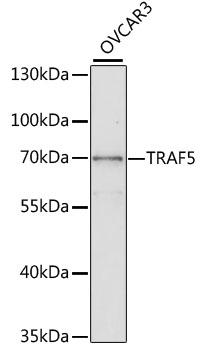 TRAF5 Antibody - Western blot analysis of extracts of OVCAR3 cells using TRAF5 Polyclonal Antibody at dilution of 1:1000.