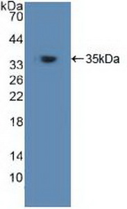 TRAF6 Antibody - Western Blot; Sample: Recombinant TRAF6, Human.