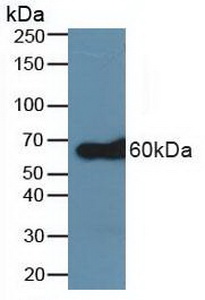 TRAF6 Antibody - Western Blot; Sample:Human A431 Cells.
