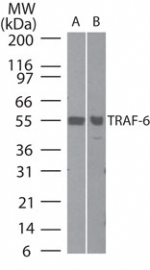 TRAF6 Antibody - Western blot of TRAF6 using antibody at 4 ug/ml in A) human thymus cell lysate and B)human testis cell lysate.