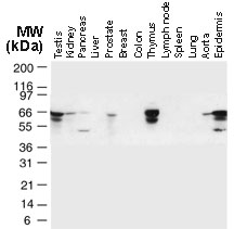 TRAF6 Antibody - Western blot of TRAF6 in normal human tissues using Polyclonal Antibody to TRAF6 at 1:2000. TRAF6 is observed at ~66 kD. Additional bands of lower molecular weight were seen in some cases, and may represent TRAF6 degradation fragments.