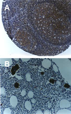 TRAF6 Antibody - Formalin-fixed, paraffin- embedded tissue sections stained for TRAF6 using Polyclonal Antibody to TRAF6 at 1:2000. Hematoxylin-Eosin counterstain. A, mouse lymph node. B, mouse bone marrow.