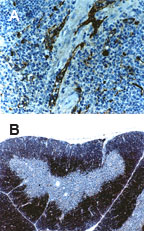 TRAF6 Antibody - Formalin-fixed, paraffin- embedded tissue sections stained for TRAF6 using Polyclonal Antibody to TRAF6 at 1:2000. Hematoxylin-Eos in counterstain. A, mouse spleen. B, mouse thymus.