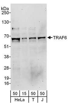TRAF6 Antibody - Detection of Human TRAF6 by Western Blot. Samples: Whole cell lysate from HeLa (15 and 50 ug), 293T (T; 50 ug) and Jurkat (J; 50 ug) cells. Antibodies: Affinity purified rabbit anti-TRAF6 antibody used for WB at 0.1 ug/ml. Detection: Chemiluminescence with an exposure time of 3 minutes.