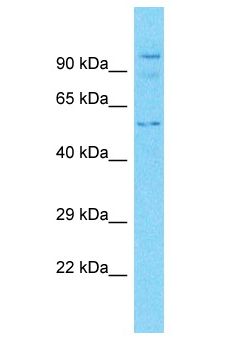 TRAF6 Antibody - TRAF6 antibody Western Blot of PANC1. Antibody dilution: 3 ug/ml.  This image was taken for the unconjugated form of this product. Other forms have not been tested.
