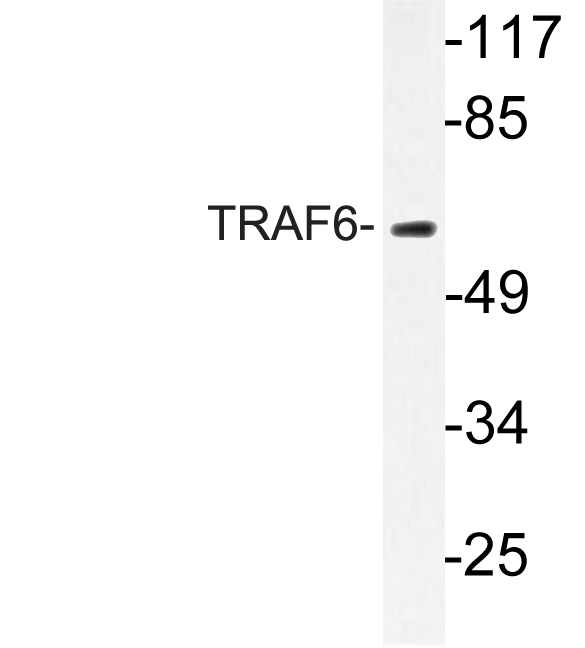 TRAF6 Antibody - Western blot of TRAF6 (H154) pAb in extracts from HeLa cells.