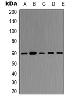 TRAF6 Antibody - Western blot analysis of TRAF6 expression in HeLa (A); K562 (B); Rat kidney (C); Rat heart (D); mouse kidney (E) whole cell lysates.
