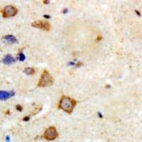 TRAF6 Antibody - Immunohistochemical analysis of TRAF6 staining in human brain formalin fixed paraffin embedded tissue section. The section was pre-treated using heat mediated antigen retrieval with sodium citrate buffer (pH 6.0). The section was then incubated with the antibody at room temperature and detected using an HRP polymer system. DAB was used as the chromogen. The section was then counterstained with hematoxylin and mounted with DPX.