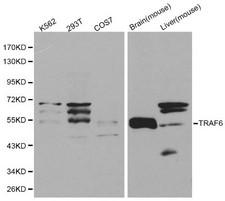 TRAF6 Antibody - Western blot of TRAF6 pAb in extracts from K562, 293T, COS7 cells and mouse brain, liver tissues.