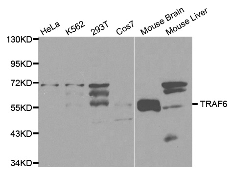TRAF6 Antibody - Western blot analysis of extracts of various cell lines, using TRAF6 antibody at 1:1000 dilution. The secondary antibody used was an HRP Goat Anti-Rabbit IgG (H+L) at 1:10000 dilution. Lysates were loaded 25ug per lane and 3% nonfat dry milk in TBST was used for blocking.