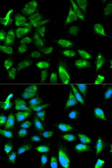 TRAF6 Antibody - Immunofluorescence analysis of HeLa cells using TRAF6 antibody. Blue: DAPI for nuclear staining.