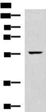TRAF6 Antibody - Western blot analysis of Mouse heart tissue lysate  using TRAF6 Polyclonal Antibody at dilution of 1:300
