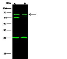TRAF6 Antibody - Anti-TRAF6 rabbit polyclonal antibody at 1:500 dilution. Lane A: Jurkat Whole Cell Lysate. Lane B: A549 Whole Cell Lysate. Lysates/proteins at 30 ug per lane. Secondary: Goat Anti-Rabbit IgG H&L (Dylight 800) at 1/10000 dilution. Developed using the Odyssey technique. Performed under reducing conditions. Predicted band size: 60 kDa. Observed band size: 60 kDa. (We are unsure as to the identity of these extra bands.)