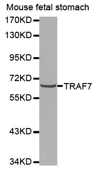 TRAF7 Antibody - Western blot analysis of extracts of mouse fetal stomach cells.