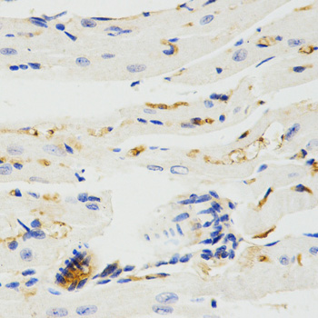 TRAF7 Antibody - Immunohistochemistry of paraffin-embedded rat heart tissue.