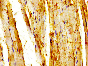 TRAF7 Antibody - Immunohistochemistry image at a dilution of 1:200 and staining in paraffin-embedded human skeletal muscle tissue performed on a Leica BondTM system. After dewaxing and hydration, antigen retrieval was mediated by high pressure in a citrate buffer (pH 6.0) . Section was blocked with 10% normal goat serum 30min at RT. Then primary antibody (1% BSA) was incubated at 4 °C overnight. The primary is detected by a biotinylated secondary antibody and visualized using an HRP conjugated SP system.
