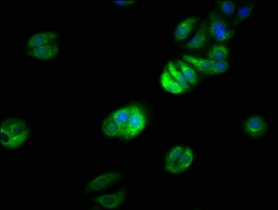 TRAF7 Antibody - Immunofluorescence staining of HepG2 cells with TRAF7 Antibody at 1:66, counter-stained with DAPI. The cells were fixed in 4% formaldehyde, permeabilized using 0.2% Triton X-100 and blocked in 10% normal Goat Serum. The cells were then incubated with the antibody overnight at 4°C. The secondary antibody was Alexa Fluor 488-congugated AffiniPure Goat Anti-Rabbit IgG(H+L).