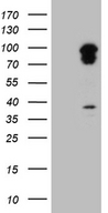 TRAFD1 / FLN29 Antibody - HEK293T cells were transfected with the pCMV6-ENTRY control. (Left lane) or pCMV6-ENTRY TRAFD1. (Right lane) cDNA for 48 hrs and lysed. Equivalent amounts of cell lysates. (5 ug per lane) were separated by SDS-PAGE and immunoblotted with anti-TRAFD1. (1:2000)