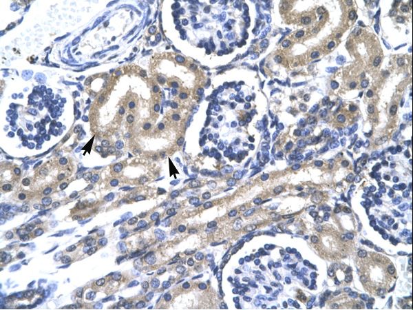 TRAFD1 / FLN29 Antibody - TRAFD1 antibody ARP32828_P050-NP_006691-TRAFD1 (TRAF-type zinc finger domain containing 1) Antibody was used in IHC to stain formalin-fixed, paraffin-embedded human kidney.  This image was taken for the unconjugated form of this product. Other forms have not been tested.
