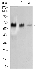 TRAFD1 / FLN29 Antibody - Western blot using TRAFD1 mouse monoclonal antibody against HEK293 (1), Raji (2), and Jurkat (3) cell lysate.
