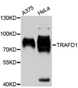 TRAFD1 / FLN29 Antibody - Western blot analysis of extracts of various cell lines, using TRAFD1 antibody at 1:1000 dilution. The secondary antibody used was an HRP Goat Anti-Rabbit IgG (H+L) at 1:10000 dilution. Lysates were loaded 25ug per lane and 3% nonfat dry milk in TBST was used for blocking. An ECL Kit was used for detection and the exposure time was 90s.