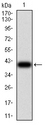 TRAG3 / CSAG2 Antibody - Western blot analysis using SAG2 mAb against Toxoplasma gondii surface antigen 2B SAG2 (AA: 1-130) recombinant protein. (Expected MW is 39.3 kDa)