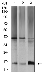 TRAG3 / CSAG2 Antibody - Western blot analysis using SAG2 mouse mAb against SW480 (1), A431 (2), and K562 (3) cell lysate.