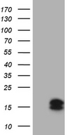 TRAG3 / CSAG2 Antibody - HEK293T cells were transfected with the pCMV6-ENTRY control. (Left lane) or pCMV6-ENTRY CSAG2. (Right lane) cDNA for 48 hrs and lysed. Equivalent amounts of cell lysates. (5 ug per lane) were separated by SDS-PAGE and immunoblotted with anti-CSAG2. (1:500)