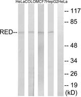 TRAG3 / CSAG2 Antibody - Western blot analysis of extracts from HeLa cells, COLO cells, MCF-7 cells and HepG2 cells, using RED antibody.
