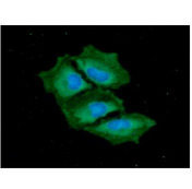 TRAIL-R3 / DCR1 Antibody - ICC/IF analysis of TNFRSF10C in HeLa cells. The cell was stained with TNFRSF10C antibody (1:100).The secondary antibody (green) was used Alexa Fluor 488. DAPI was stained the cell nucleus (blue).