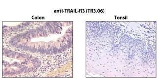 TRAIL-R3 / DCR1 Antibody - Immunohistochemistry detection of endogenous TRAIL-R3 in paraffin-embedded human carcinoma tissues (colon, tonsil) using mAb to TRAIL-R3 (TR3.06) .