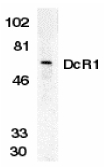 TRAIL-R3 / DCR1 Antibody - Western blot of DcR1 in HeLa whole cell lysate with DcR1 antibody at 1 ug/ml.