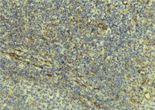 TRAIL-R3 / DCR1 Antibody - 1:100 staining human lymph tissue by IHC-P. The sample was formaldehyde fixed and a heat mediated antigen retrieval step in citrate buffer was performed. The sample was then blocked and incubated with the antibody for 1.5 hours at 22°C. An HRP conjugated goat anti-rabbit antibody was used as the secondary.