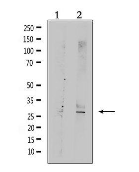 TRAIL-R3 / DCR1 Antibody - Western blot analysis of extracts of rat muscle using TNFRSF10C antibody. Lane 1 was treated with the antigen-specific peptide.