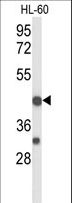 TRAIL-R4 / DCR2 Antibody - Western blot of TNFRSF10D Antibody in HL-60 cell line lysates (35 ug/lane). TNFRSF10D (arrow) was detected using the purified antibody.