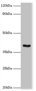 TRAIL-R4 / DCR2 Antibody - Western blot All lanes: Tumor necrosis factor receptor superfamily member 10D antibody at 2µg/ml + Mouse liver tissue Secondary Goat polyclonal to rabbit IgG at 1/10000 dilution Predicted band size: 42 kDa Observed band size: 42 kDa