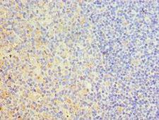 TRAIL-R4 / DCR2 Antibody - Immunohistochemistry of paraffin-embedded human tonsil using antibody at 1:100 dilution.