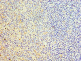 TRAIL-R4 / DCR2 Antibody - Immunohistochemistry of paraffin-embedded human tonsil tissue using TNFRSF10D Antibody at dilution of 1:100