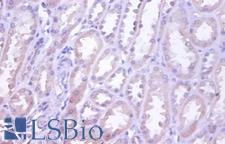 TRAIL-R4 / DCR2 Antibody - Immunohistochemistry of paraffin-embedded human kidney using TNFRSF10D / TRAIL-R4 / DCR2 antibody at dilution of 1:100.  This image was taken for the unconjugated form of this product. Other forms have not been tested.