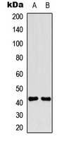 TRAIL-R4 / DCR2 Antibody - Western blot analysis of CD264 expression in Jurkat (A); NIH3T3 (B) whole cell lysates.