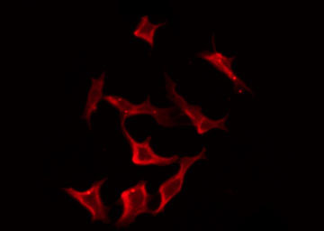TRAIL-R4 / DCR2 Antibody - Staining HeLa cells by IF/ICC. The samples were fixed with PFA and permeabilized in 0.1% Triton X-100, then blocked in 10% serum for 45 min at 25°C. The primary antibody was diluted at 1:200 and incubated with the sample for 1 hour at 37°C. An Alexa Fluor 594 conjugated goat anti-rabbit IgG (H+L) Ab, diluted at 1/600, was used as the secondary antibody.