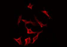 TRAIL-R4 / DCR2 Antibody - Staining HeLa cells by IF/ICC. The samples were fixed with PFA and permeabilized in 0.1% Triton X-100, then blocked in 10% serum for 45 min at 25°C. The primary antibody was diluted at 1:200 and incubated with the sample for 1 hour at 37°C. An Alexa Fluor 594 conjugated goat anti-rabbit IgG (H+L) Ab, diluted at 1/600, was used as the secondary antibody.