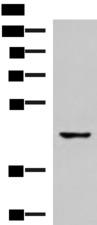 TRAIL-R4 / DCR2 Antibody - Western blot analysis of 293T cell lysate  using TNFRSF10D Polyclonal Antibody at dilution of 1:500